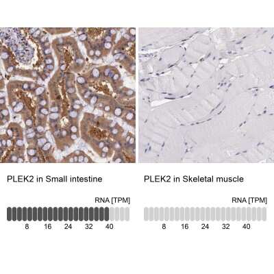 Immunohistochemistry-Paraffin: Pleckstrin-2 Antibody [NBP1-86180]