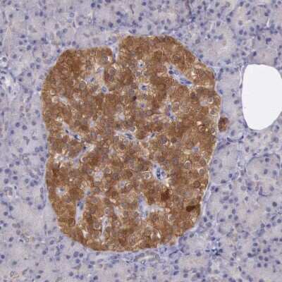 Immunohistochemistry-Paraffin: Pleckstrin-2 Antibody [NBP1-86180]
