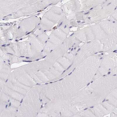 Immunohistochemistry-Paraffin: Pleckstrin-2 Antibody [NBP1-86180]