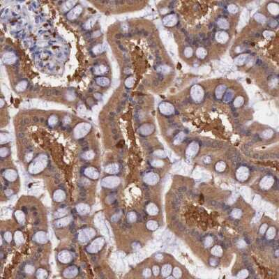 Immunohistochemistry-Paraffin: Pleckstrin-2 Antibody [NBP1-86180]