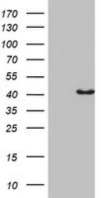 Western Blot: Pleckstrin-2 Antibody (OTI5D3)Azide and BSA Free [NBP2-73467]