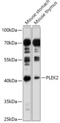 Western Blot: Pleckstrin-2 AntibodyAzide and BSA Free [NBP3-03395]