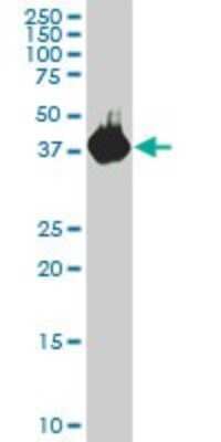 Western Blot: Pleckstrin Antibody (2D8) [H00005341-M03]