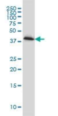 Western Blot: Pleckstrin Antibody (6E3) [H00005341-M01]