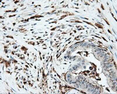 Immunohistochemistry-Paraffin: Pleckstrin Antibody (OTI6H8) [NBP2-02300]