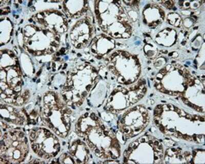 Immunohistochemistry-Paraffin: Pleckstrin Antibody (OTI6H8) [NBP2-02300]