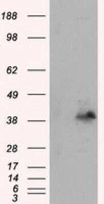 Western Blot: Pleckstrin Antibody (OTI6H8) [NBP2-02300]