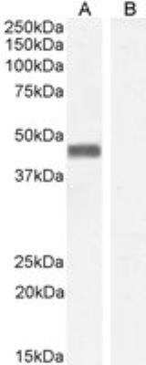 Western Blot: Pleckstrin Antibody [NB100-1343]