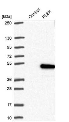 Western Blot: Pleckstrin Antibody [NBP1-87370]