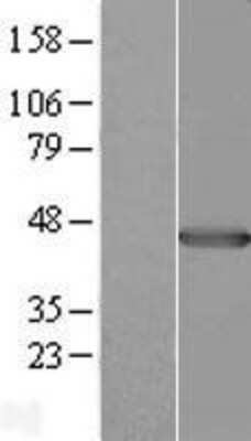 Western Blot: Pleckstrin Overexpression Lysate [NBL1-14499]