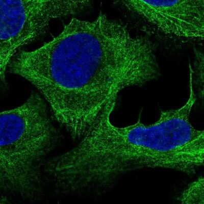 Immunocytochemistry/ Immunofluorescence: Plectin Antibody [NBP1-84020]