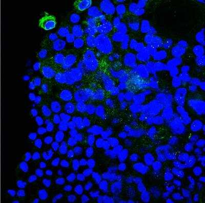 Immunocytochemistry/ Immunofluorescence: Plectin Antibody [NBP1-84020]