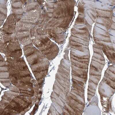 Immunohistochemistry-Paraffin: Plectin Antibody [NBP1-84019]