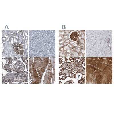 Immunohistochemistry-Paraffin: Plectin Antibody [NBP1-84019]