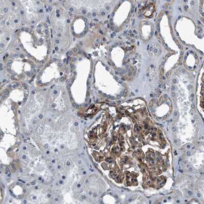 Immunohistochemistry-Paraffin: Plectin Antibody [NBP1-84019]