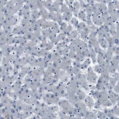 Immunohistochemistry-Paraffin: Plectin Antibody [NBP1-84019]