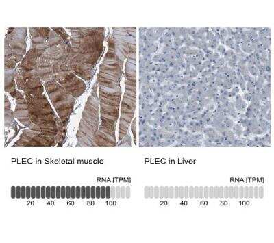 Immunohistochemistry-Paraffin: Plectin Antibody [NBP1-84019]