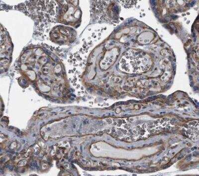 Immunohistochemistry-Paraffin: Plectin Antibody [NBP1-84019]