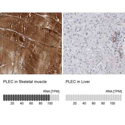 Immunohistochemistry-Paraffin: Plectin Antibody [NBP1-84020]