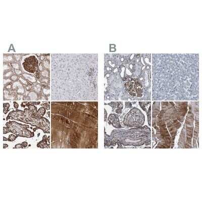 Immunohistochemistry-Paraffin: Plectin Antibody [NBP1-84020]