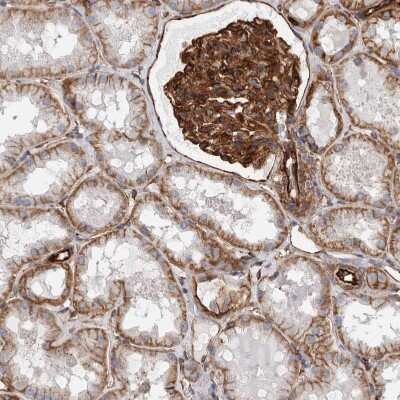 Immunohistochemistry-Paraffin: Plectin Antibody [NBP1-84020]