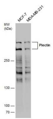 Western Blot: Plectin Antibody [NBP3-12950]