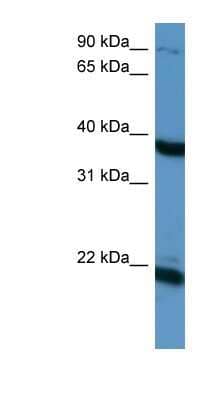 Western Blot: Pleiotrophin/PTN Antibody [NBP1-58286]