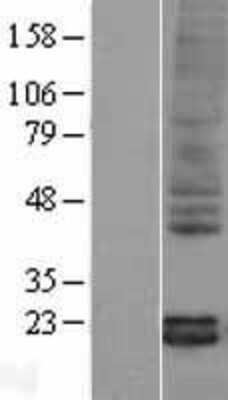 Western Blot: Pleiotrophin/PTN Overexpression Lysate [NBL1-14957]