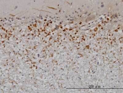 Immunohistochemistry-Paraffin: Pleiotrophin/PTN Antibody (1E7) [H00005764-M03]