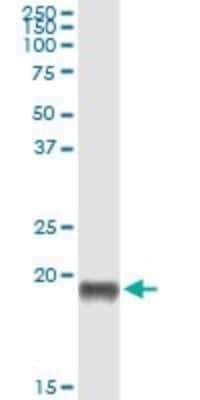 Western Blot: Pleiotrophin/PTN Antibody (1E7) [H00005764-M03]