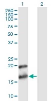 Western Blot: Pleiotrophin/PTN Antibody (2E3) [H00005764-M02]