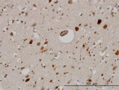 Immunohistochemistry-Paraffin: Pleiotrophin/PTN Antibody (5C3) [H00005764-M01]