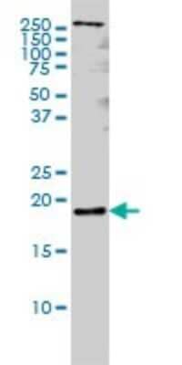 Western Blot: Pleiotrophin/PTN Antibody (5C3) [H00005764-M01]