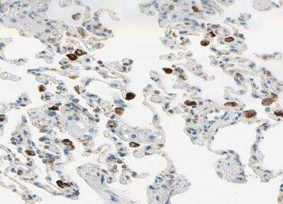 Immunohistochemistry-Paraffin: Plexin A1 Antibody [NBP1-82544]