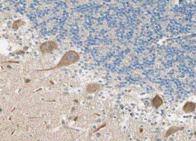Immunohistochemistry-Paraffin: Plexin A1 Antibody [NBP1-82544]