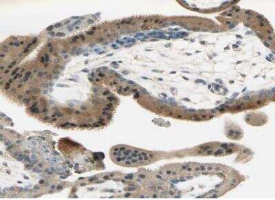 Immunohistochemistry-Paraffin: Plexin A1 Antibody [NBP1-82544]