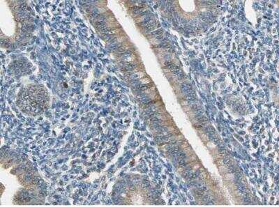 Immunohistochemistry-Paraffin: Plexin A1 Antibody [NBP1-82544]