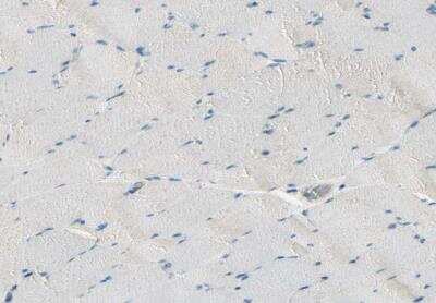 Immunohistochemistry-Paraffin: Plexin A1 Antibody [NBP1-82544]