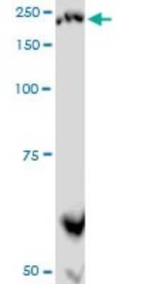 Western Blot: Plexin A2 Antibody (2G5) [H00005362-M06]