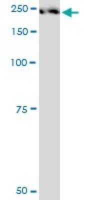 Western Blot: Plexin A2 Antibody (2G5) [H00005362-M06]