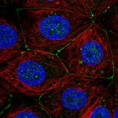 Immunocytochemistry/ Immunofluorescence: Plexin A3 Antibody [NBP2-56699]