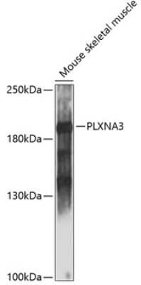 Western Blot: Plexin A3 AntibodyAzide and BSA Free [NBP2-93993]