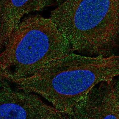 Immunocytochemistry/ Immunofluorescence: Plexin A4 Antibody [NBP2-69011]