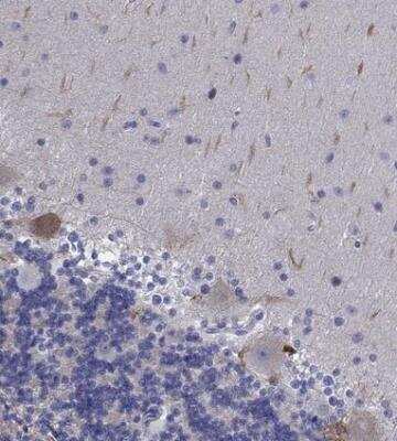 Immunohistochemistry-Paraffin: Plexin A4 Antibody [NBP1-85128]