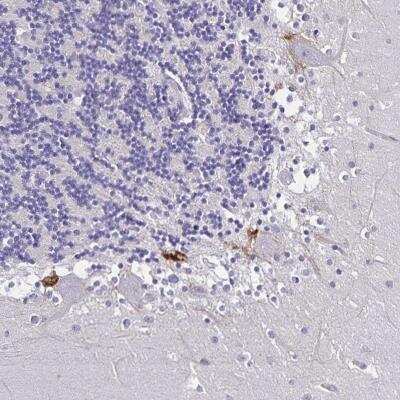 Immunohistochemistry-Paraffin: Plexin A4 Antibody [NBP2-38663]