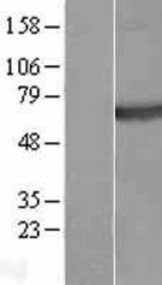 Western Blot: Plexin A4 Overexpression Lysate [NBL1-14533]