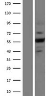 Western Blot: Plexin A4 Overexpression Lysate [NBP2-11421]