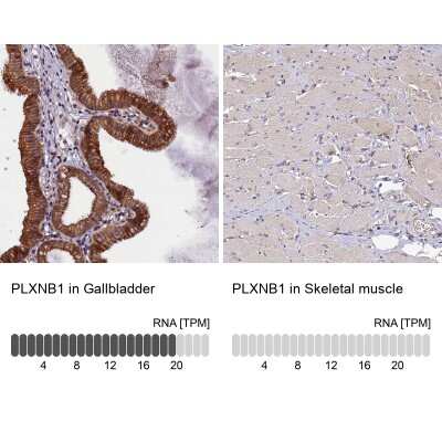 Immunohistochemistry-Paraffin: Plexin B1 Antibody [NBP1-87782]