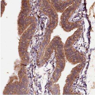Immunohistochemistry-Paraffin: Plexin B1 Antibody [NBP1-87782]