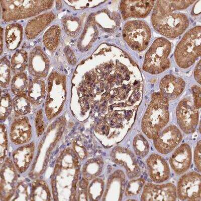 Immunohistochemistry-Paraffin: Plexin B1 Antibody [NBP1-87782]